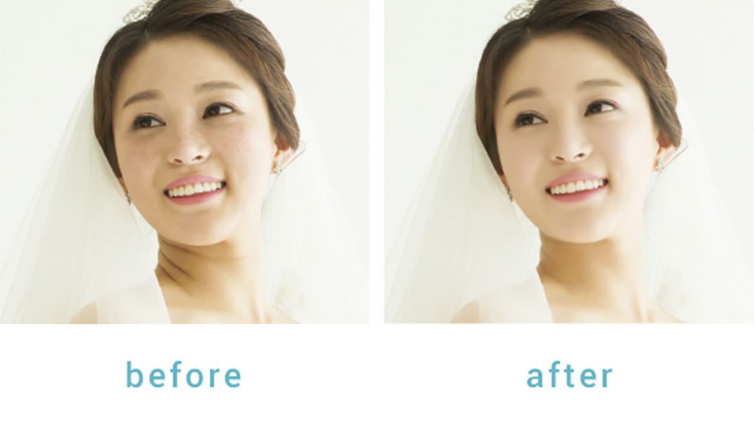 PhotoBridge®の美肌加工オプション